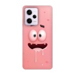Кейс за Xiaomi 557 Patrick Star