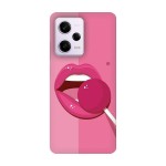 Кейс за Xiaomi 591 Близалка